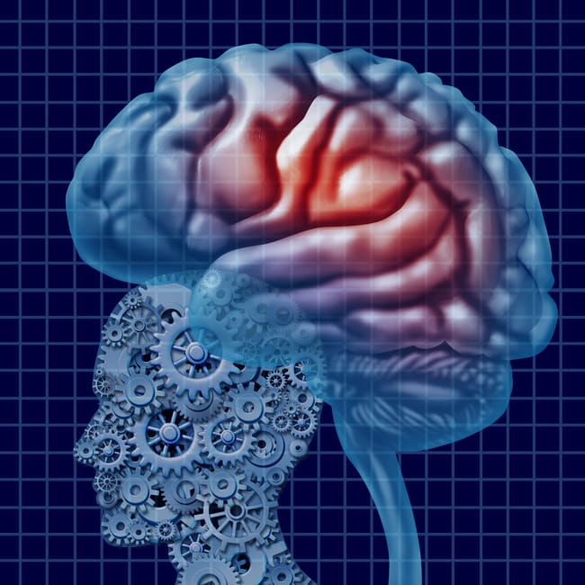 Onderzoek naar MRI-innovaties tegen dementie krijgt subsidie
